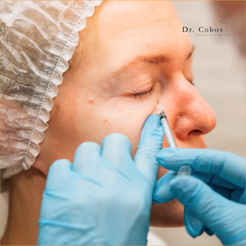 Rellenos con ácido hialurónico en Terrassa