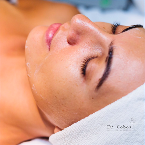 Hilos tensores en Terrassa para mejorar la flacidez